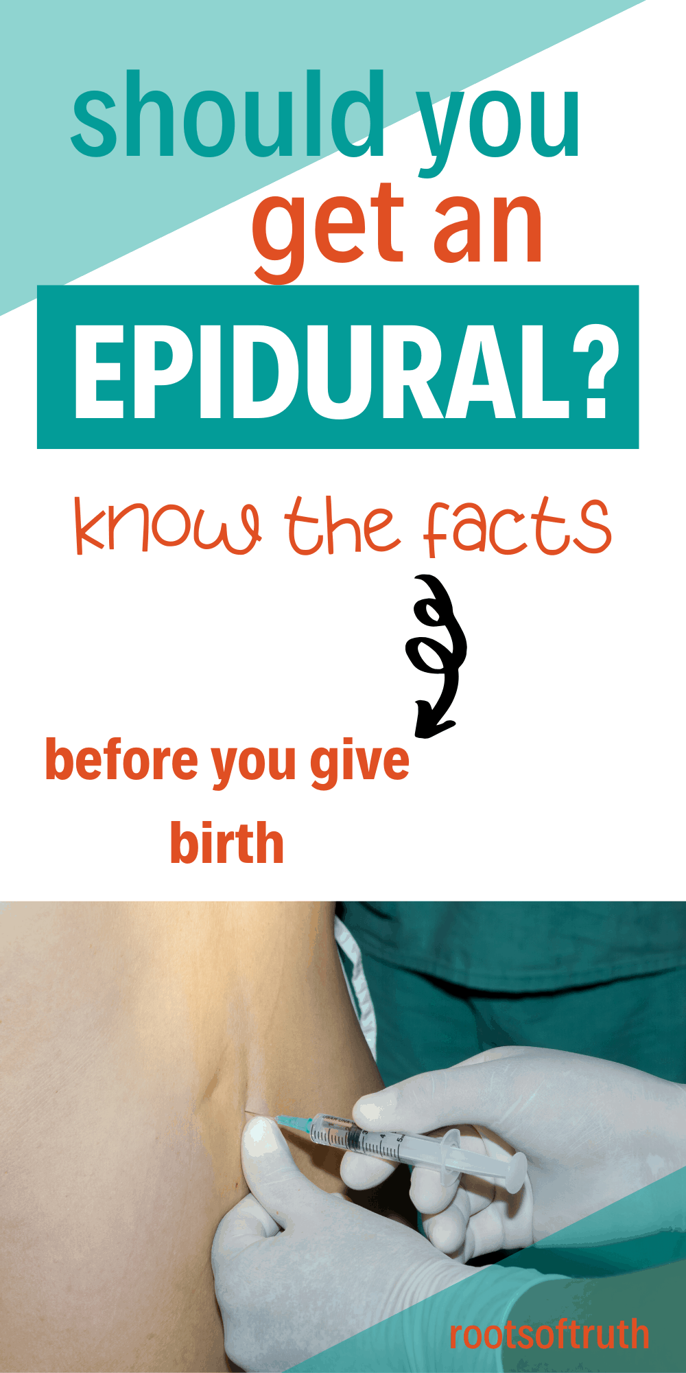 Epidurals Should You Get One?